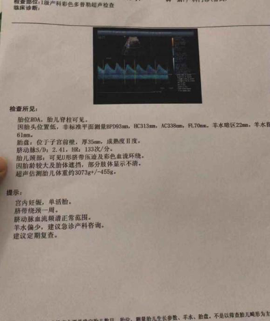 图片 1.png